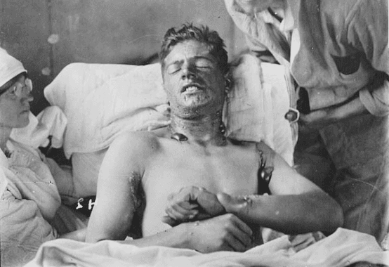 A wounded soldier treated in a field hospital